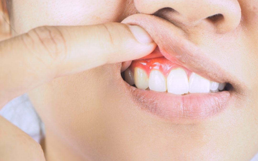 gum disease preventive dentistry Surprise
