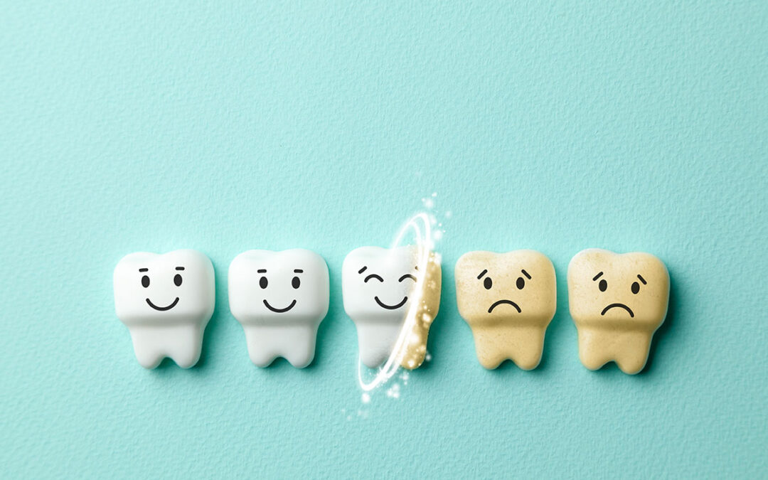 6 Ways Tried and True Ways to Prevent Yellow Teeth - West Bell Dental Care