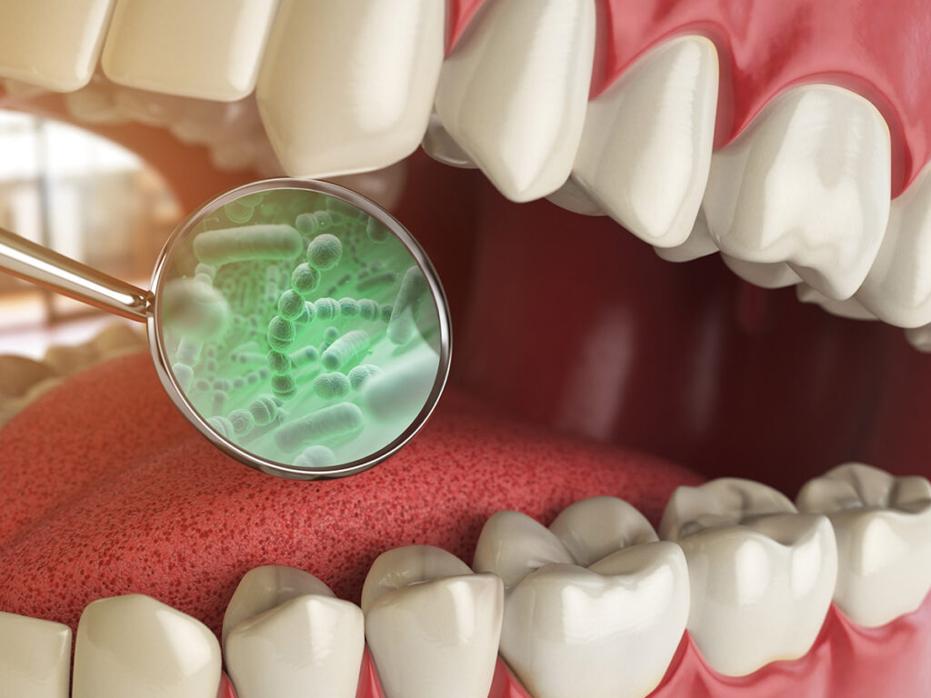 mouth bacteria, best dentist Surprise