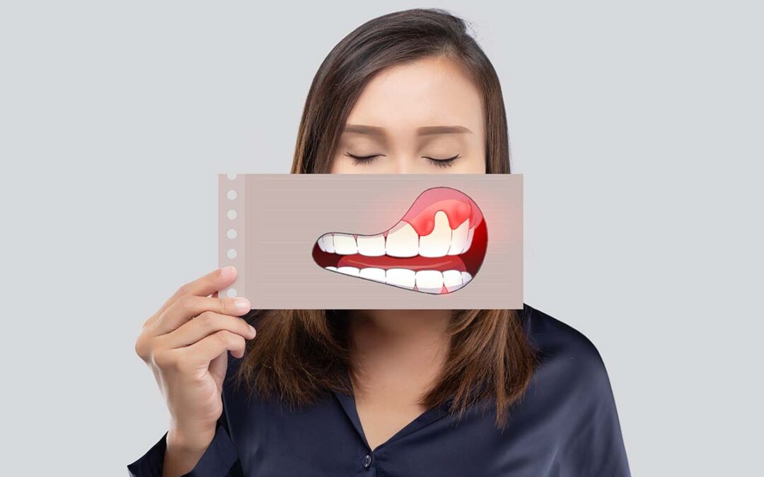Oral Cancer Screening: 9 Reasons to Make the Dental Appointment Now