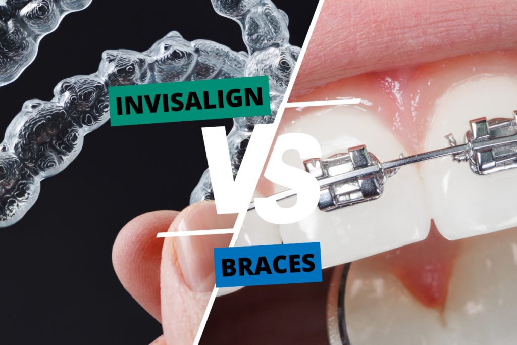 Invisalign Surprise AZ